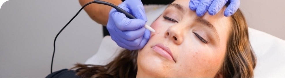 Woman getting skin treatment