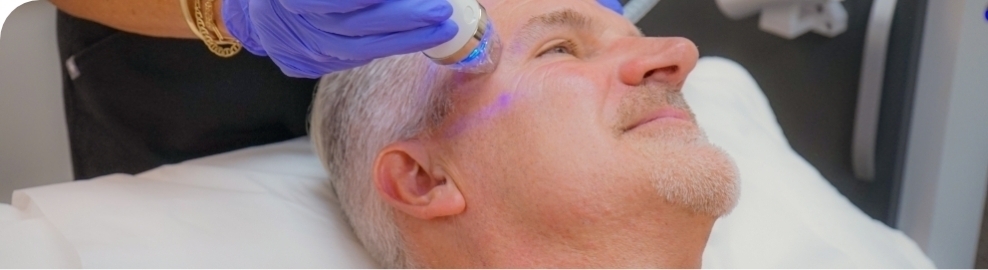 Man getting microneedling 